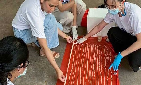 Thailand: A 60-Foot-Long Worm was Found in a Patient's Abdomen