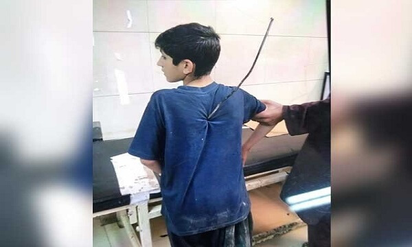 Jinnah Hospital Doctors Accomplish A Very Complicated Operation On A 14-Year-Old Boy