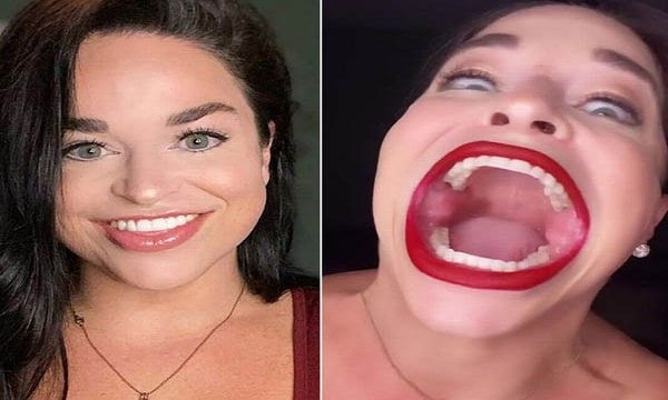 Women with World's Largest Mouth Became a Millionaire